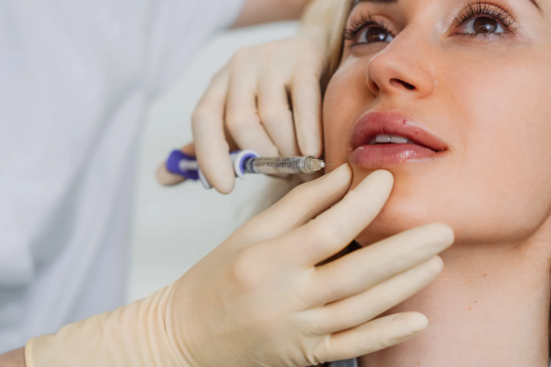 Hyaluron-Filler Behandlung in Winterthur